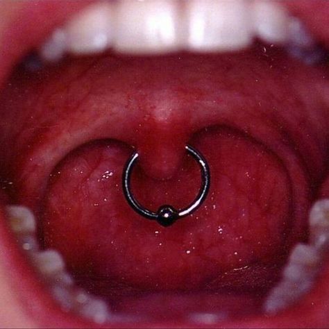 Piercing Mouth, Teeth Ring, Strep Throat, Don't Worry, Disease, Piercings, Jam, Ring