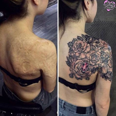 Shoulder Blade Tattoos, Scar Cover Up, Shoulder Blade Tattoo, Tattoos To Cover Scars, Scar Tattoo, Blackwork Tattoos, Tattoo Cover Up, Weird Tattoos, Tattoo Cover