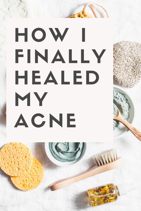 Do you struggle with acne? In this post I talk about how I naturally cleared my acne and tips YOU can apply to heal your acne from the inside out. Prevent Acne Tips, Foods To Reduce Acne, Acne Gut Health, Clean Eating For Acne, Foods To Avoid With Acne, Heal Acne Naturally, Foods For Acne Free Skin, Natural Ways To Clear Acne, Healing Acne Scarring