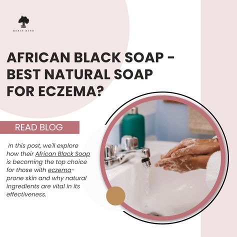 Finding the right skincare products can be challenging regarding eczema or atopic dermatitis. Many commercial soaps and body washes contain harsh ingredients like lauryl sulfate, which can strip the skin of its natural oils, making them bad news for eczema sufferers.   African Black Soap is a great choice for those with irritated eczema and sensitive skin made with all-natural ingredients, this incredible soap has been used in various African countries as a go-to remedy for various skin issues. African Skin Care, African Black Soap, Body Washes, Black Soap, Daily Skin Care Routine, African Countries, Skin Issues, Organic Skin, Skincare Ingredients