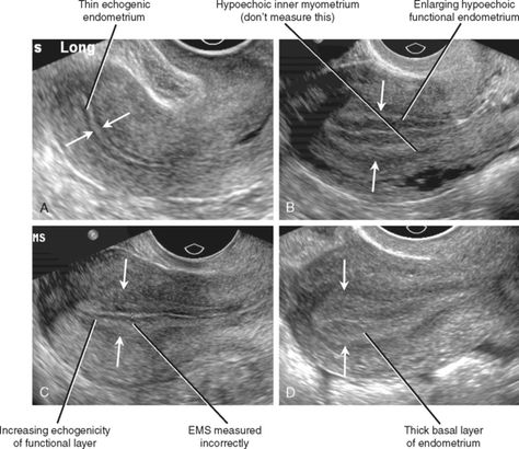 Ultrasound School, Obstetric Ultrasound, Vascular Ultrasound, Sonography Student, Ultrasound Sonography, Medical Ultrasound, Diagnostic Medical Sonography, Ultrasound Technician, Radiology Imaging