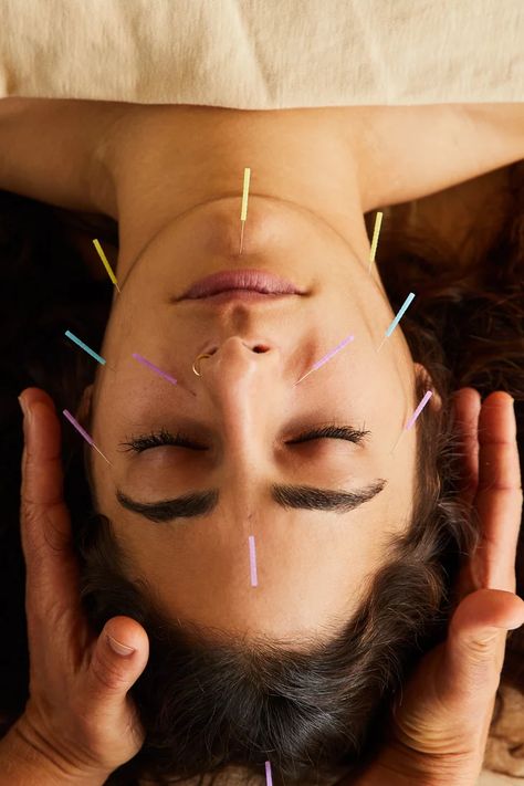 Cosmetic Acupuncture, Forward Head Posture Exercises, Facial Cupping, Forward Head Posture, Natural Beauty Treatments, Facial Rejuvenation, Acupuncture Points, Popsugar Beauty, Homemade Face Masks