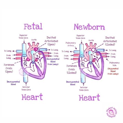 Obgyn Medical Assistant, Nurse Midwife Student, Diagnostic Medical Sonography Student Notes, Sonography Student Notes, Sonography Student Study Obgyn, Nicu Nurse Study Notes, Nicu Nurse Notes, Pediatric Cardiac Sonography, Midwifery Student Notes