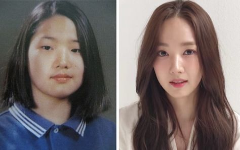 Kpop Idols Plastic Surgery Before And After, Celebrity Plastic Surgery Before After, Korean Plastic Surgery Before And After, Plastic Surgery Before And After, Kpop Plastic Surgery, Popular Korean Drama, Plastic Surgery Korea, Lim Ji Yeon, Korean Plastic Surgery