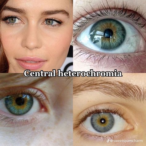 Central Heterochromia, Pretty Eyes Color, Heterochromia Eyes, Arte Bob Marley, Rare Eye Colors, Eye Color Chart, Rare Eyes, Beautiful Eyes Color, Aesthetic Eyes