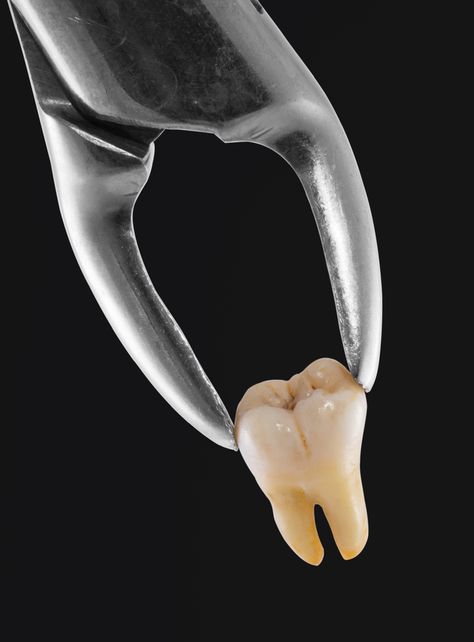 History of Dentistry - Learn about ancient dental implants and Elizabethan tooth-blackening techniques! Dental Pictures, Dental Wallpaper, Dental Advertising, Dental Images, Dental Posts, Dental Aesthetics, Dental Photography, Dentistry Student, Aesthetic Dentistry