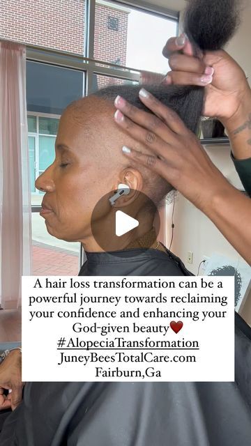 Bald Sides Hairstyles Black Women, Alopecia Ponytail Hairstyles, Hairstyles For No Edges Black Women, Braids For Alopecia For Black Women, No Edges Hairstyles Black Women, Alopecia Braid Styles, Alopecia Hairstyles Black Women, Hairstyles For Alopecia, Older Black Women Hairstyles Over 50