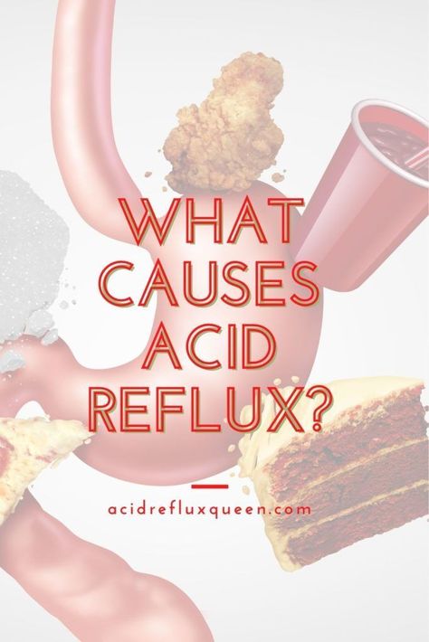 Dealing with chronic acid reflux for GERD and not sure why? Here's the common causes of acid reflux and how you can treat it naturally. Get rid of acid reflux. Natural remedies for acid reflux. GERD treatments. How to get rid of heartburn. Prevent heartburn and acid reflux. #acidreflux #heartburn #gerd What Causes Acid Reflux, Acid Reflux Relief, Reflux Disease, Stomach Acid, Body Healing, Sodium Bicarbonate, Acid Reflux, Digestion Problems, Natural Treatments