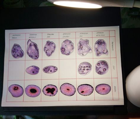 Entamoeba histolytica (Trophozoite, Cyst and Nucleus) Entamoeba coli (Trophozoite, Cyst and Nucleus) Entamoeba gingivalis (Trophozoite, Cyst and Nucleus)  Endolimax nana (Trophozoite, Cyst and Nucleus) Iodamoeba bütschlii (Trophozoite, Cyst and Nucleus)  Diemtamoeba fragilis (Trophozoite, Cyst and Nucleus) Entamoeba Histolytica, Vet Life, Medical Lab, Medical Laboratory, Exam Prep, Hand Drawing, Study Motivation, Anatomy, How To Draw Hands