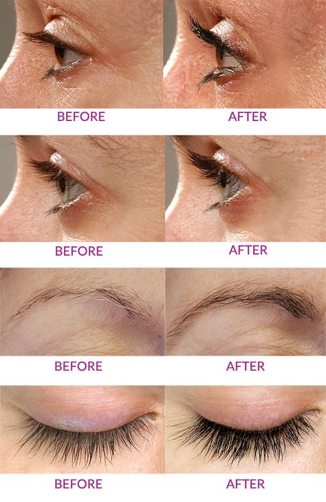 Rapid Lash #beforeandafter Rapid Lash Before And After, Eyelash Extensions Aftercare, Rapid Lash, Effective Skin Care Routine, Beauty And The Beat, Eyebrow Grooming, Tanning Cream, Diy Eyelash Extensions, Take Care Of Your Skin