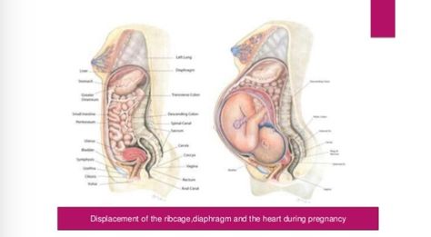 Organ displacement in pregnancy Prenatal Massage, Pregnancy Labor, Pregnancy Body, Post Baby Body, Breast Health, Pregnancy Health, Pregnancy Symptoms, Body Organs, Post Baby