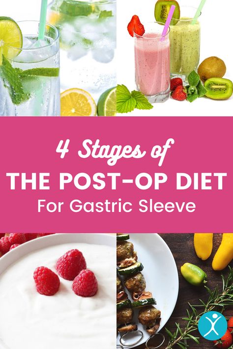 Vsg Diet Plan Post Op, Gastric Bypass Sleeve Post Op Liquid Diet, Post Vsg Meal Plan, Bariatric Meal Plan Post Op Stage 2, Post Op Bariatric Diet Stages, Pre Op Sleeve Diet, Vsg Food Stages, Gastric Bypass Post Op Diet, Eating After Bariatric Sleeve Surgery