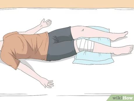 3 Ways to Sleep After a Knee Replacement - wikiHow Sleeping After Knee Replacement, Knee Replacement Humor, Full Knee Replacement, After Knee Replacement Surgery, Knee Replacement Exercises, Knee Replacement Recovery, Knee Surgery Recovery, Knee Operation, Knee Care