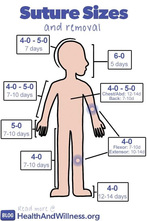 How to suture - suture size and removal How To Dress Like A Nurse Practitioner, Memes Nursing, Nurse Practitioner Week, Surgical Technologist Student, Nursing Hacks, Nursing Pictures, Nurse Practitioner Student, Np School, Nurse Uniforms