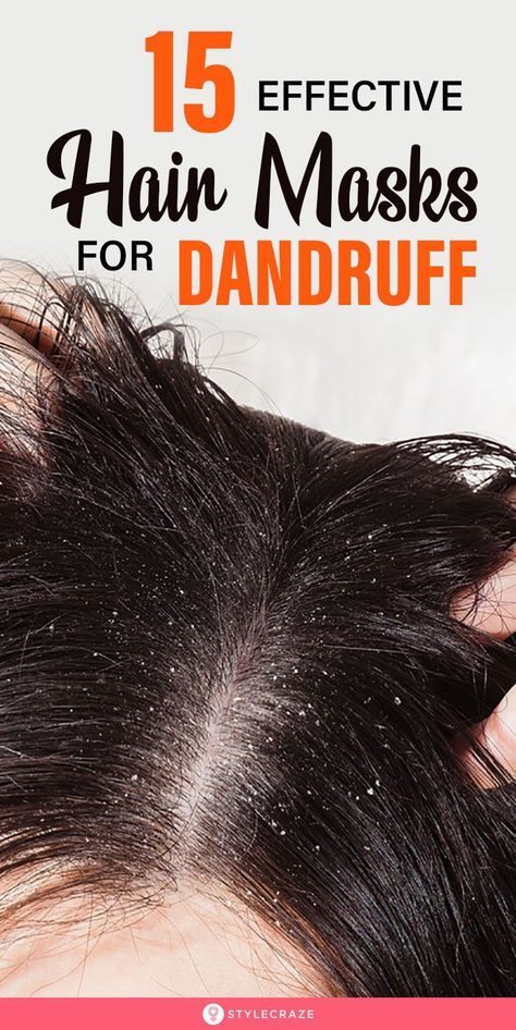 Hair Masks For Dandruff, Mayonnaise Hair Mask, Hair Mask For Dandruff, Rid Of Dandruff, Homemade Hair Mask, Dandruff Remedy, Getting Rid Of Dandruff, Best Hair Mask, Dandruff Treatment