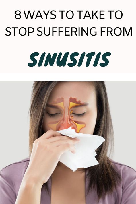 sinusitis remedies Severe Headache, Dry Cough, Sinus Congestion, S Alphabet, Nasal Congestion, Runny Nose, Quality Of Life, Headache, Facial