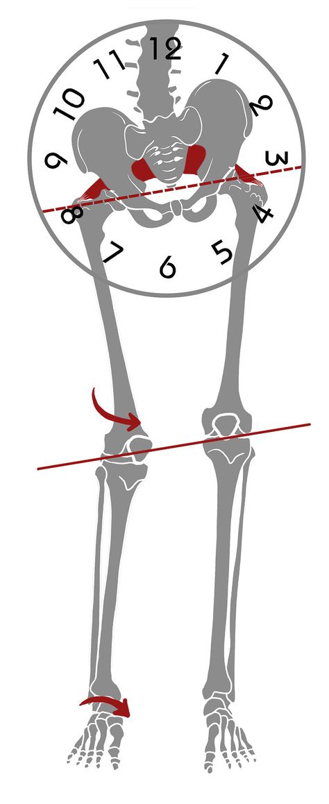 Hip Alignment, Piriformis Muscle, Hip Pain Relief, Piriformis Syndrome, Back Stretches For Pain, Pelvic Tilt, Muscle Imbalance, Back Pain Exercises, Hip Pain