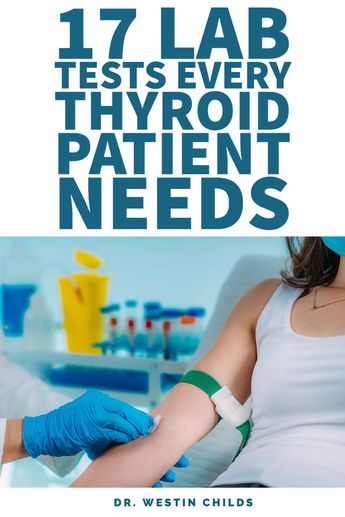 Low Thyroid Remedies, Thyroid Remedies, Thyroid Levels, Thyroid Healing, Thyroid Test, Low Thyroid, Thyroid Symptoms, Hashimotos Disease, Thyroid Medication