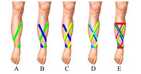 how to tape for shin splints-where have you been all my life?! Shin Splints Taping, Recovery Exercises, Shin Splint Exercises, K Tape, Kinesiology Taping, Shin Splints, Athletic Training, Sports Injury, Sports Medicine