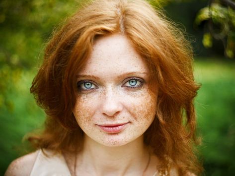 Certain genetic traits are incredibly rare in humans, especially relating to hair and eye colour, but the intersection of rare traits? Super rare. Rarest Hair Color, Rare Eye Colors, Cool Looking People, Vibrant Red Hair, Rare Eyes, Laser Clinic, Intense Pulsed Light, Beautiful Freckles, Laser Clinics