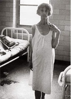 1960s patient at a mental institution Insane Asylum Patients, Lunatic Asylum, Mental Asylum, Mental Institution, Abandoned Asylums, Insane Asylum, Psychiatric Hospital, Abandoned Hospital, Mental Hospital