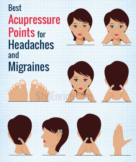 Acupressure Points for Headache & Migraines #acupressure #acupressure Acupressure Points For Headache, Tension Headache Relief, Natural Migraine Relief, Headache Relief Instant, Acupuncture Benefits, Massage Therapy Techniques, Migraine Pain, For Headaches, Headache Prevention