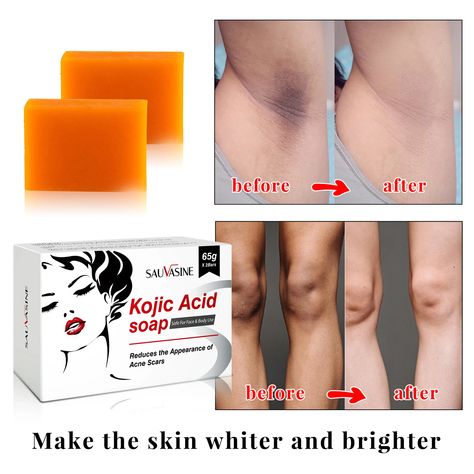 Kojic Acid Whitening Soap 2 PCS Kit Handmake Reduce Drak Spot Melasma Deep Clean Brightening Skin Retinol Face Cream, Skin Lightening Soap, Kojic Acid Soap, Cream For Dark Spots, Tone Skin, Skin Lightening, Whitening Soap, Lighten Skin, Kojic Acid