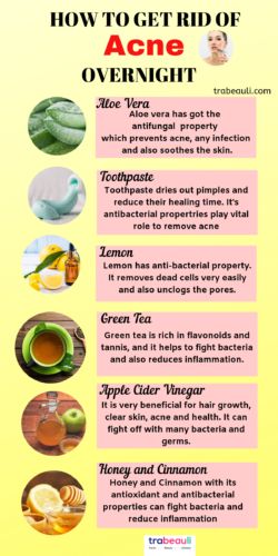 Want to know how to get rid of acne naturally? Yes, We have listed simple home remedies and easy ways to remove pimple. #acne #homeremedies #howto Face Treatments For Acne, Acne Natural Remedies, Herb Magick, Acne Home Remedies, Natural Remedies For Acne, Treat Acne Naturally, Dry Out Pimples, Back Acne Remedies, Acne Scaring