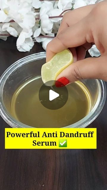 How To Get Rid Of Hair Fall, How To Get Rid Of Dandruff Fast At Home, How To Get Rid Of Dandruff, Get Rid Of Dandruff Fast, Neem Leaves, Lemon Juice Uses, Rid Of Dandruff, Dandruff Hair, Fast Hair Growth