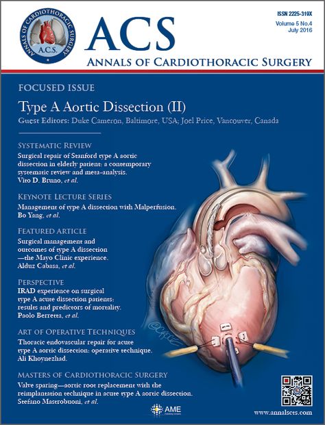 Vol 5, No 4 (July 2016) - Annals of Cardiothoracic Surgery Nursing Tools, Cardiothoracic Surgery, School Planning, Pa School, Medicine Student, School Plan, Pre Med, Social Determinants Of Health, Medical Knowledge