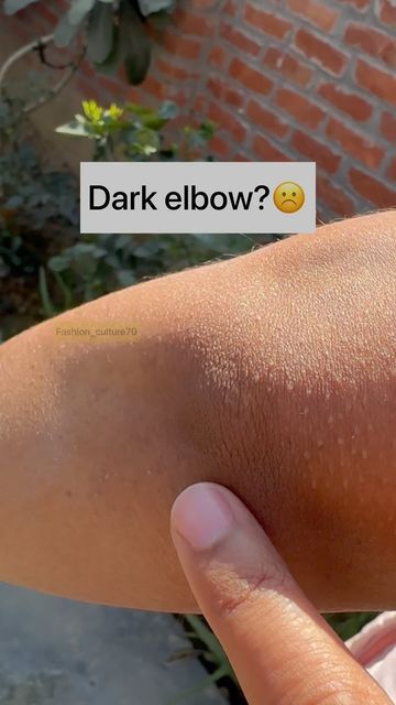 fashion_culture70 on Instagram: "Dark elbow?☹️ Try this remedy❤️ Follow @fashion_culture70 for more videos #reels #darknessremoval #darkneck #suntan #suntanremoval #skincaretips #glowup #haircare #viral #viralvideos #explore #instagram" Natural Skin Care Ingredients, Diy Skin Care Routine, Natural Face Skin Care, Tips Skincare, Good Skin Tips, Basic Skin Care Routine, Perfect Skin Care Routine, Homemade Beauty, Homemade Beauty Tips