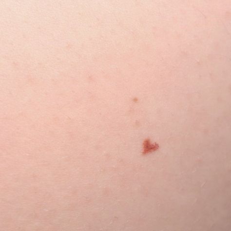 Heart Beauty Mark Tattoo, Heart Tattoo Freckle, Tattoo Beauty Mark, Heart Shaped Freckles, Heart Beauty Mark, Beauty Marks On Face, Heart Freckle Tattoo, Beauty Mark Tattoo, Heart Freckles