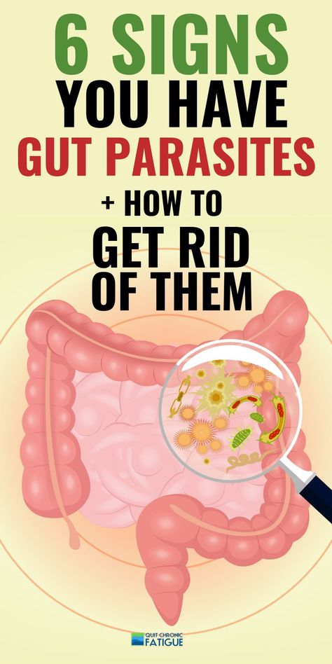 Stomach parasites symptoms - are they causing your fatigue or other health issues? #stoamchparasitessymptoms #stomachparasites #stomachparasitecleanse Parasites Symptoms, Intestinal Parasites, Cleaning Your Colon, Parasite Cleanse, Stomach Issues, Stomach Problems, Home Health Remedies, Colon Cleanse, Natural Health Remedies