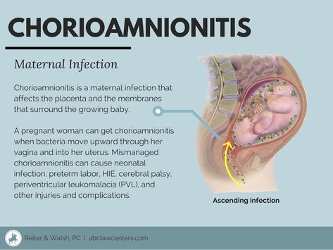 Uterine Rupture Nursing, Obstetrics Nursing, Certified Nurse Midwife, Newborn Nursing, Midwifery Student, Student Midwife, Nursing School Essential, Ob Nursing, Nursing Mnemonics