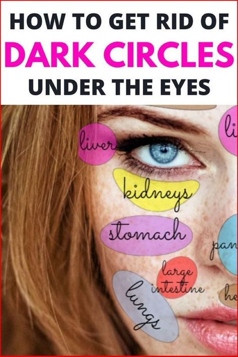 Remove The Dark Circles And Bags Under The Eyes With This Natural And Easy Treatments!!! Remove Dark Eye Circles, Eye Bag Remedies, Dark Circle Remedies, Remove Eye Bags, Dark Circles Under The Eyes, Herbal Therapy, Dark Eye Circles, Face Mapping, Under Eye Wrinkles