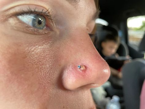 Nose Piercing On Crooked Nose, Small Nose Rings, Gold Nostril Ring, Nose Piercing Irritation Bump, Nose Piercing On Different Nose Shapes, Nose Studs Aesthetic, Nose Piercing Multiple, Nose Peirce Chart, Nose Piercing On Small Nose