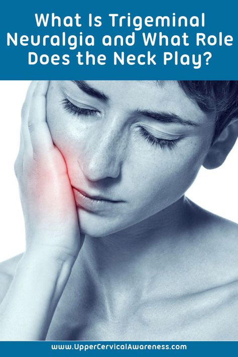 Trigeminal Nerve Pain, Trigeminal Neurology, Trigeminal Nerve Pain Relief, Vegas Nerve, Trigeminal Nerve, Upper Cervical Chiropractic, Occipital Neuralgia, Pinched Nerve, Jaw Pain