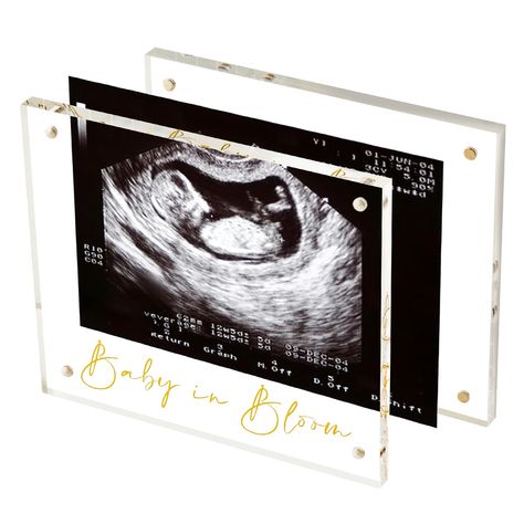 Ultrasound scrapbook