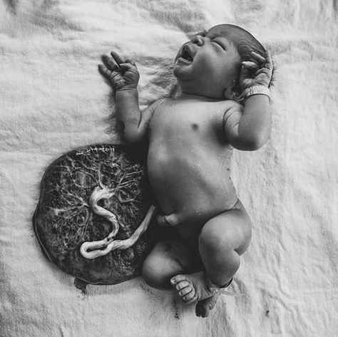 Birth Photoshoot, Birth Photography Hospital, Doula Art, Home Birth Photography, Informed Consent, Birth Photos, Hospital Birth, Hospital Photos, Yoga Center