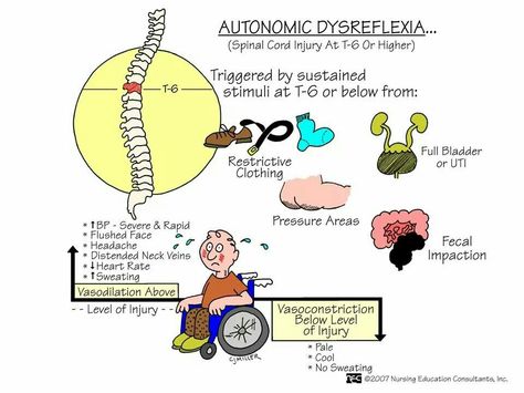 Autonomic Dysreflexia Autonomic Dysreflexia, Nursing Study Tips, Medical Assisting, Concept Maps, Nursing Board, Med Surg Nursing, Student Info, Gastrointestinal System, Nursing Mnemonics