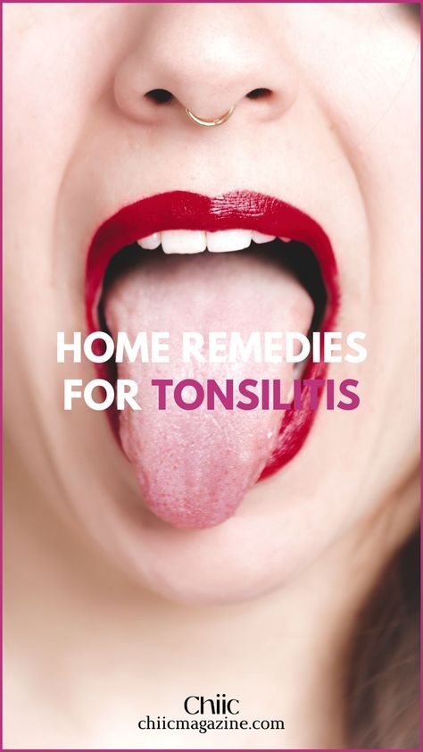 Easy Ways to Cure Tonsillitis Throat Infection Remedy, Glam Wedding Makeup, Viral Infection, Women Magazines, Health Advice, Natural Treatments, Health Lifestyle, Blood Pressure, Home Remedies