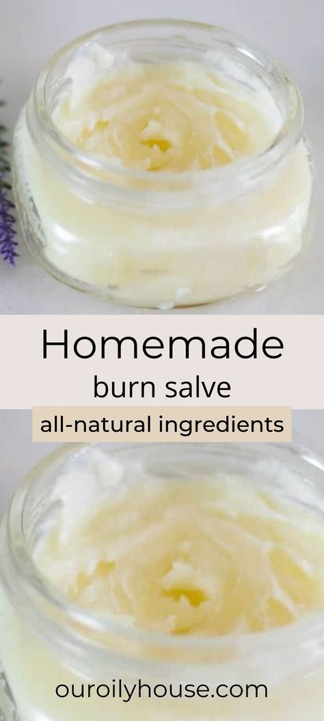 Burn Salve, Burn Ointment, Burn Remedy, Salve Recipes, Healing Salves, Cold Sores Remedies, Cleaner Recipes, Natural Sleep Remedies, Natural Cold Remedies