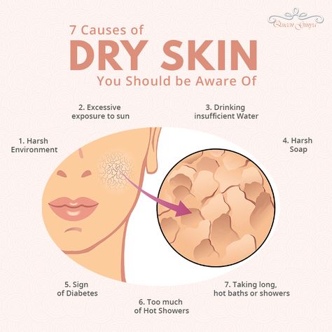 Skin Information, Ordinary Serum, Dry Skin Causes, Remove Skin Tags Naturally, Skincare Facts, Skin Booster, Skin Facts, Skin Care Business, Skin Advice