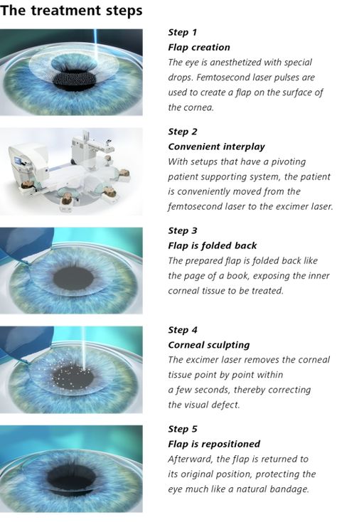 Lasik Eye Surgery, Medical Transcription, Laser Eye Surgery, Lasik Surgery, Laser Eye, Laser Surgery, Eye Center, Eye Surgery, Surgery Recovery