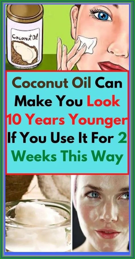 Coconut Oil Can Make You Look 10 Years Younger If You Use It For 2 Weeks This Way #youngerlook #coconutoil Onion Juice, Health Dinner, Health Planner, Fitness Advice, Wrinkle Remover, Years Younger, Health Facts, Health Remedies, Easy Workouts