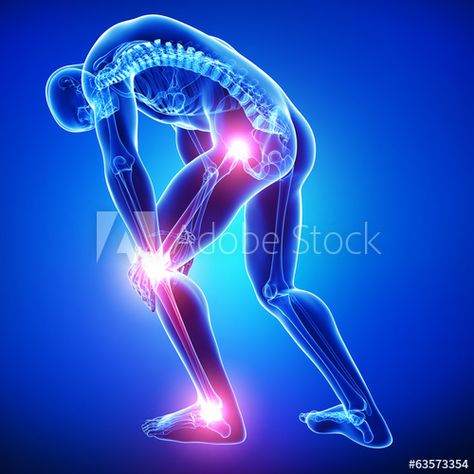 Chronic Pain Management, Body Joints, Leg Pain, Chiropractic Care, Knee Pain, Chronic Pain, Back Pain, Pain Relief, Home Remedies