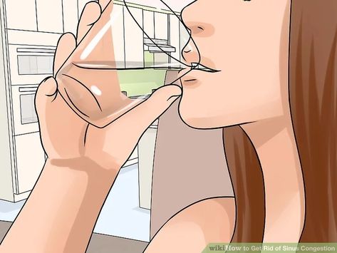 How to Get Rid of Sinus Congestion: 13 Steps (with Pictures) Swollen Sinuses, Sinus Infection Relief, Drain Sinuses, Nasal Congestion Relief, Congestion Remedies, Sinus Drainage, Sinus Remedies, Congested Nose, Sinus Congestion Relief