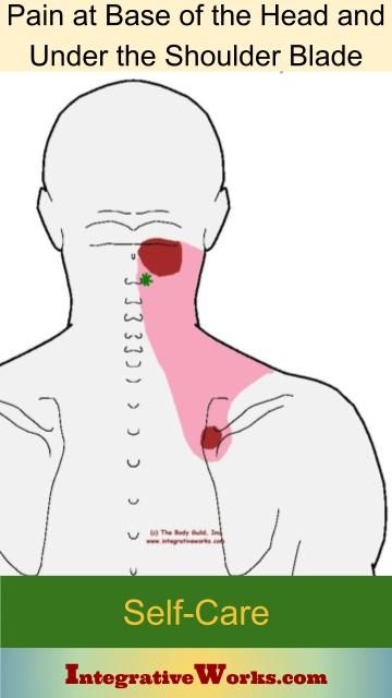 Shoulder Pain Remedies, Punkty Spustowe, Forward Head Posture Exercises, Neck And Shoulder Exercises, Pain Relief Remedies, Forward Head Posture, Shoulder Pain Relief, Neck Exercises, Stiff Neck