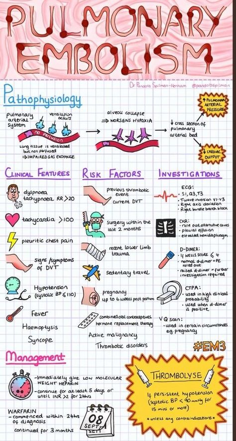 Pulmonary Embolism Infographic Pathophysiology Nursing, Paramedic School, Nursing Information, Med Surg Nursing, Nurse Study Notes, Nursing Mnemonics, Nursing Student Tips, Cardiac Nursing, Nursing School Survival