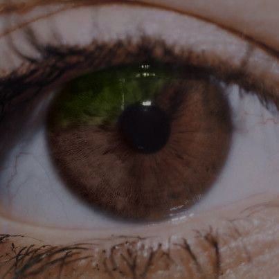 #eyes #brown #heterochromia Pretty Heterochromia Eyes, Green Brown Heterochromia, Sectoral Heterochromia Green, Green And Brown Heterochromia, Brown Eyes With Green Flecks, Heterochromia Eyes Brown And Green, Green Heterochromia Eyes, Heterochromia Character Design, Cara Core